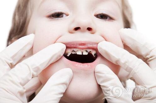 石家庄供卵机构qq群-婴儿牙齿上的黑点是由于蛀牙造成的吗？