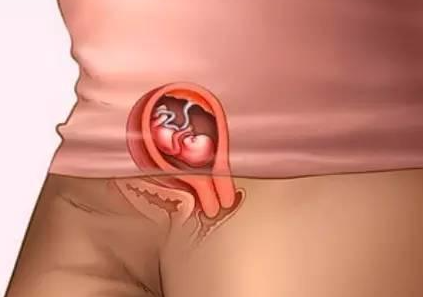 周口58岁助孕龙凤胎-怀孕第10周胎儿稳定吗,胎儿在第10周成形了