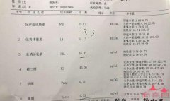 杭州46岁供卵试管助孕：备孕时有必要做